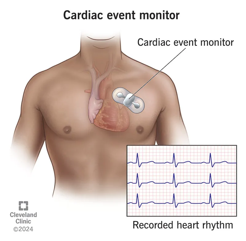 Event Monitor